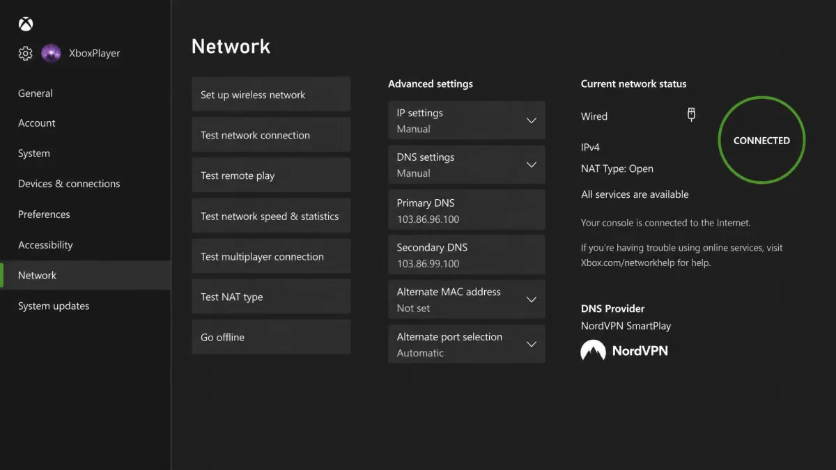 An Xbox network settings screen showing manual DNS entries for NordVPN SmartPlay, with the connection status reading connected.